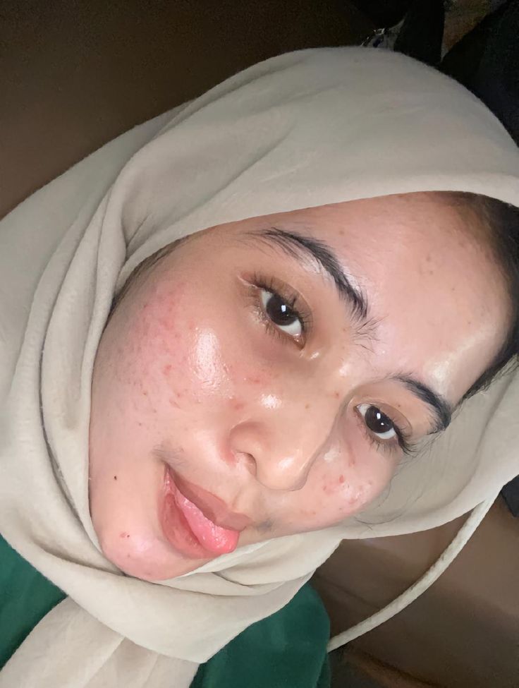 Viral 2025 Hijab Abg 2025 Terbaru Indo Yang Masih Gurih Dan Kriuk Jadi Pusat Icikiwir Global Trending Top New